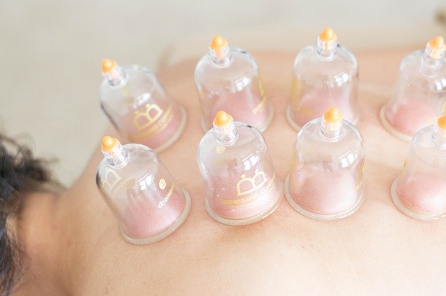 Cupping Pasadena, CA