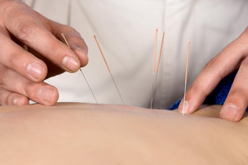 Acupuncture in Pasadena, CA